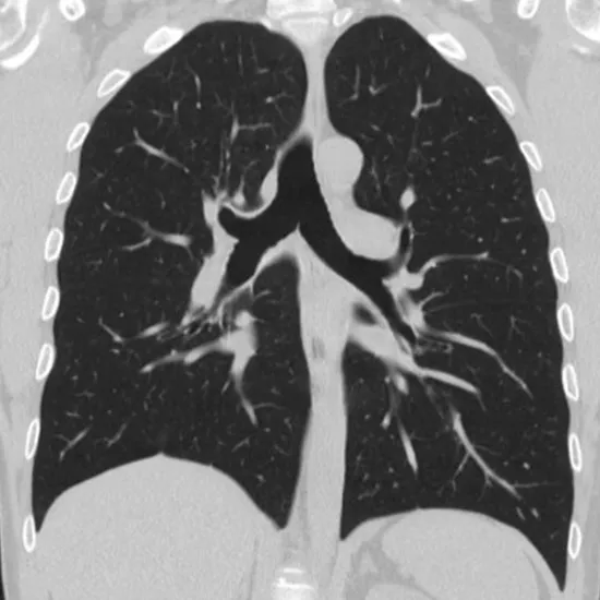 CT Thorax Test